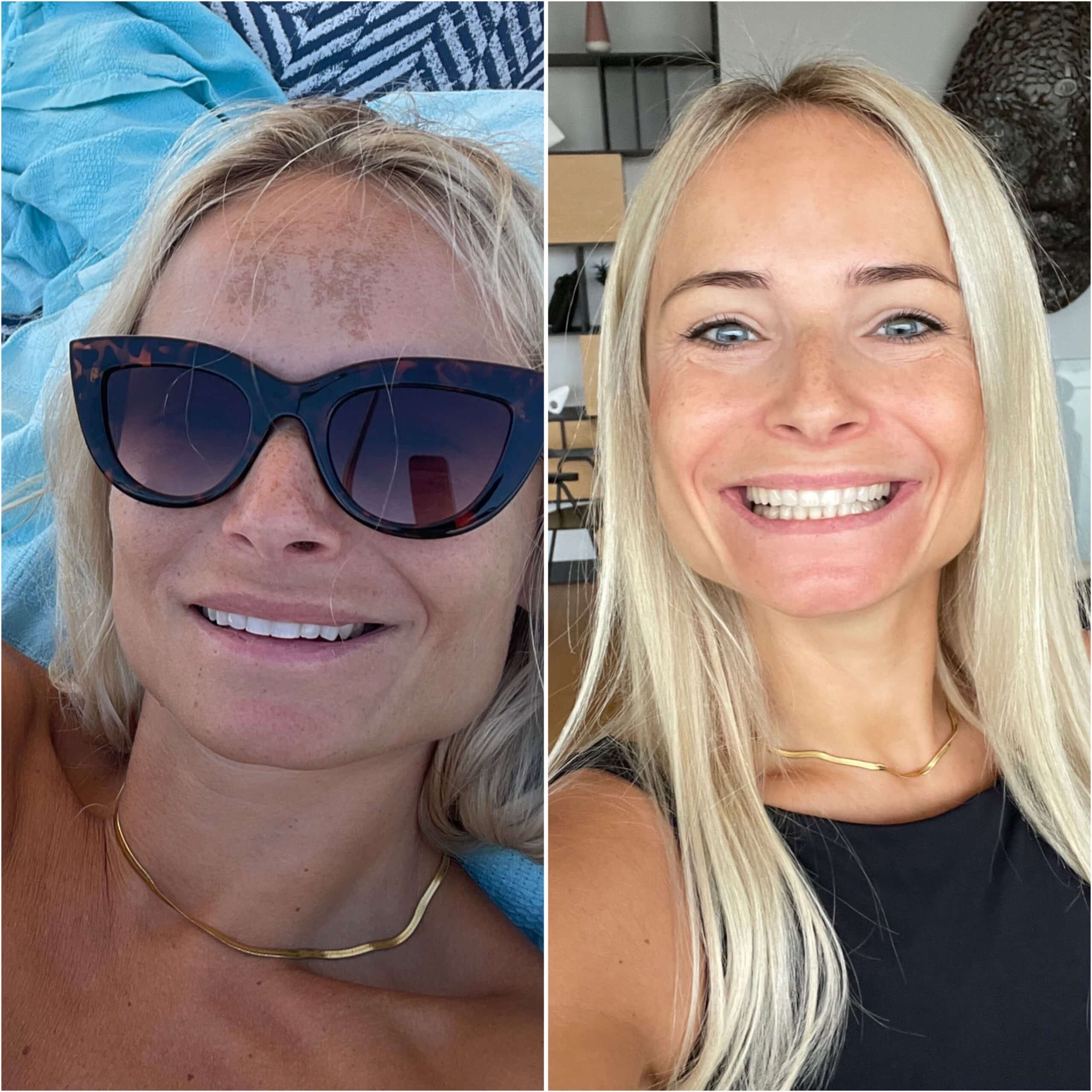 Bild der Produktoption